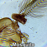 Clip on Microscope